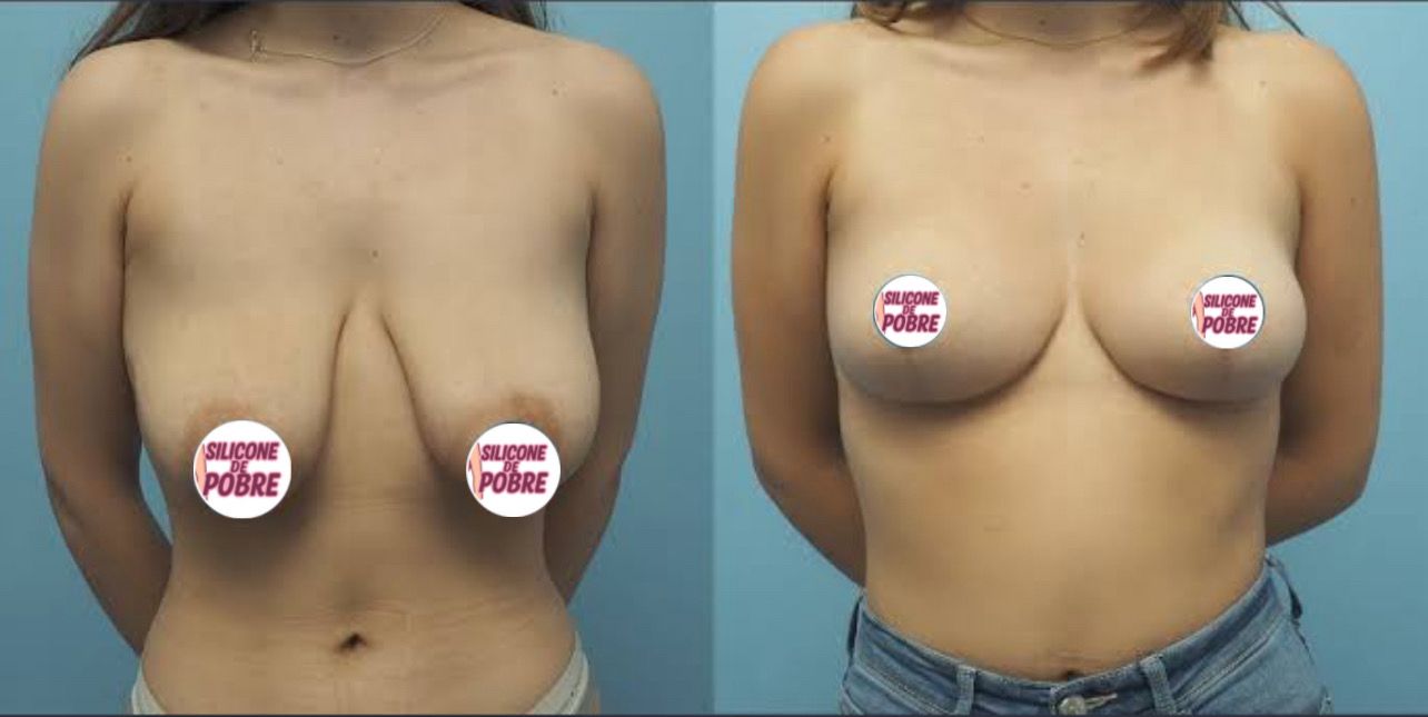Transformação