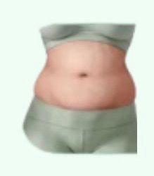 Corpo Flácido